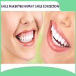 أفضل علاج لتجميل الابتسامة في دبي، الإمارات العربية المتحدة image